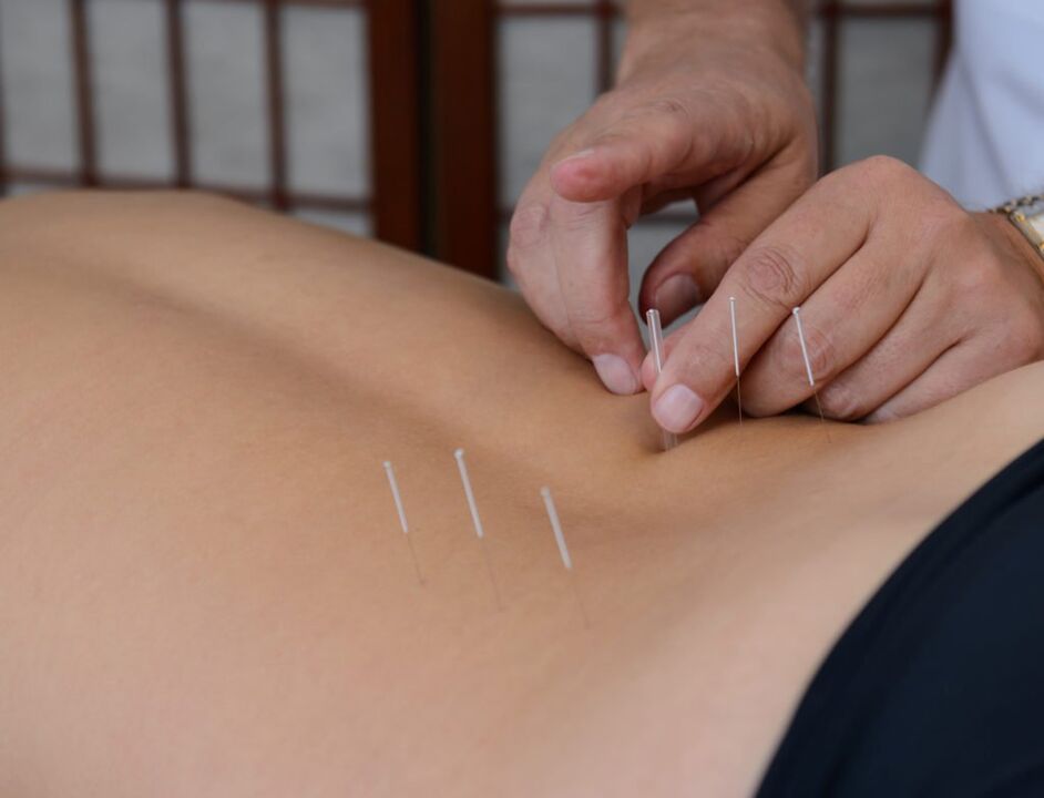 acupuncture pour la prostatite