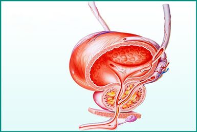 L'inflammation de la prostate dans la prostatite aiguë est une limitation des relations sexuelles